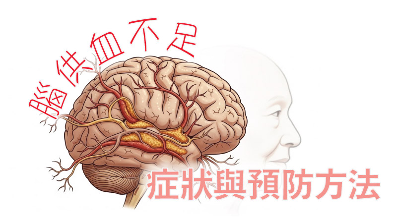 腦供血不足症狀與預防方法